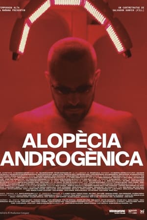 Alopècia androgènica